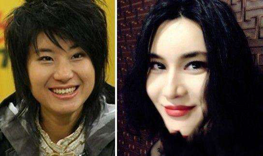 整容整丑了的明星，審美變遷下的遺憾案例，審美變遷下的明星整容遺憾案例，從美到丑的遺憾經(jīng)歷