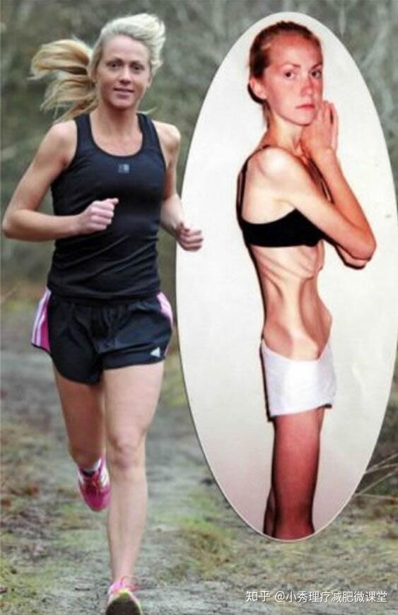 厭食癥的十大前兆，識(shí)別并預(yù)防的早期跡象，厭食癥的早期識(shí)別與預(yù)防，十大前兆詳解