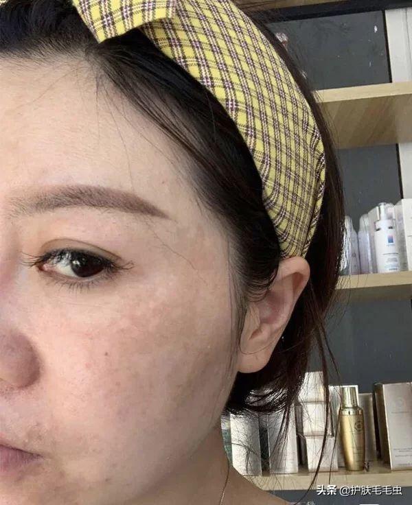 怎樣有效的淡化黃褐斑——全方位美白祛斑攻略，全方位美白祛斑攻略，如何有效淡化黃褐斑