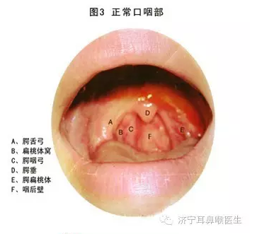 慢性咽炎三天斷根，真相還是幻想？，慢性咽炎三天斷根，真相還是幻想？揭秘治療真相。
