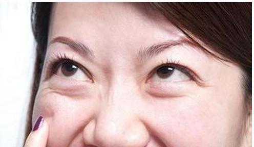 如何消除眼袋，方法與技巧詳解，消除眼袋的有效方法與技巧全解析