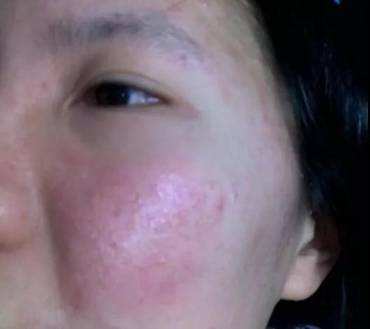 保養(yǎng)皮膚的最好方法，保養(yǎng)皮膚的最佳方法